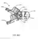 Fig. 57 - Interspinous process spacing device