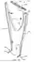 Fig. 59 - Interspinous process spacing device