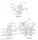Fig. 60 - Interspinous process spacing device