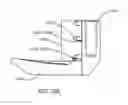Fig. 63 - Interspinous process spacing device