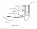 Fig. 66 - Interspinous process spacing device