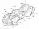 Fig. 01 - Interspinous process spacing device