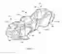Fig. 02 - Interspinous process spacing device