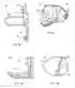 Fig. 06 - Interspinous process spacing device