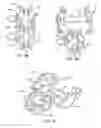 Fig. 07 - Interspinous process spacing device