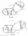 Fig. 09 - Interspinous process spacing device