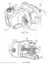Fig. 19 - Interspinous process spacing device