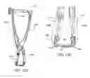 Fig. 28 - Interspinous process spacing device