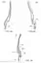 Fig. 29 - Interspinous process spacing device