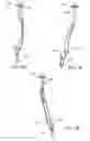 Fig. 30 - Interspinous process spacing device
