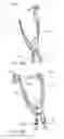 Fig. 32 - Interspinous process spacing device