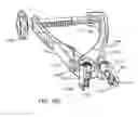 Fig. 33 - Interspinous process spacing device