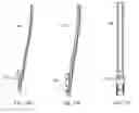 Fig. 35 - Interspinous process spacing device
