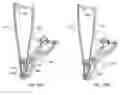 Fig. 37 - Interspinous process spacing device