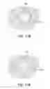 Fig. 13 - Fusion implant