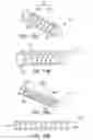 Fig. 18 - Fusion implant