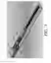 Fig. 04 - Internal bone lengthener device and method of use thereof