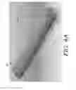 Fig. 05 - Internal bone lengthener device and method of use thereof