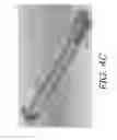 Fig. 07 - Internal bone lengthener device and method of use thereof