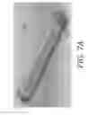 Fig. 11 - Internal bone lengthener device and method of use thereof