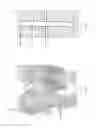 Fig. 06 - STRESS SHIELDING AND VARIABLE TENSIONING SYSTEM FOR PELVIC FRACTURE MANAGEMENT OF OSTEOPOROTIC BONES
