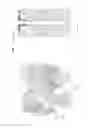 Fig. 07 - STRESS SHIELDING AND VARIABLE TENSIONING SYSTEM FOR PELVIC FRACTURE MANAGEMENT OF OSTEOPOROTIC BONES