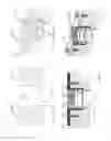 Fig. 15 - STRESS SHIELDING AND VARIABLE TENSIONING SYSTEM FOR PELVIC FRACTURE MANAGEMENT OF OSTEOPOROTIC BONES