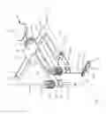 Fig. 02 - Moveable bone plate implantation system and method of use
