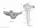 Fig. 06 - Anatomical humeral fixation system and method