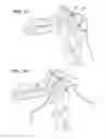 Fig. 09 - Anatomical humeral fixation system and method