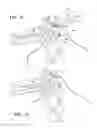 Fig. 10 - Anatomical humeral fixation system and method