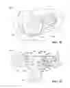 Fig. 14 - Anatomical humeral fixation system and method