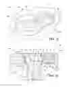 Fig. 16 - Anatomical humeral fixation system and method