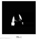 Fig. 03 - Screw fixing apparatus