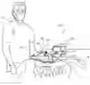 Fig. 01 - Devices for performing a medical procedure within an appropriate interval and related systems and methods