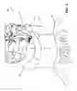 Fig. 06 - Devices for performing a medical procedure within an appropriate interval and related systems and methods