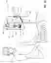 Fig. 11 - Devices for performing a medical procedure within an appropriate interval and related systems and methods