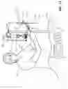 Fig. 12 - Devices for performing a medical procedure within an appropriate interval and related systems and methods
