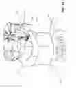 Fig. 13 - Devices for performing a medical procedure within an appropriate interval and related systems and methods