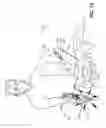 Fig. 16 - Devices for performing a medical procedure within an appropriate interval and related systems and methods