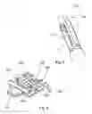 Fig. 06 - System for handling an augmentation implant