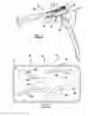 Fig. 02 - CLAVICLE BENDING TEMPLATES