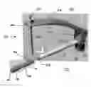 Fig. 01 - Bone fracture fixation device with transverse set screw and aiming guide