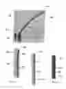 Fig. 07 - Bone fracture fixation device with transverse set screw and aiming guide