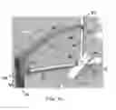 Fig. 11 - Bone fracture fixation device with transverse set screw and aiming guide