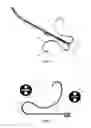 Fig. 03 - Self-centering multiray ablation catheter