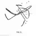 Fig. 05 - Self-centering multiray ablation catheter