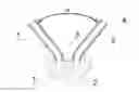 Fig. 01 - HIGH PERFORMANCE MATERIAL FOR ELECTRO-SURGICAL VAPORIZATION ELECTRODES