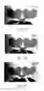 Fig. 04 - METHOD OF MAKING A SURGICAL INSTRUMENT WITH HIGH CONTRAST MARKING