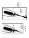 Fig. 03 - Dental screwdriver